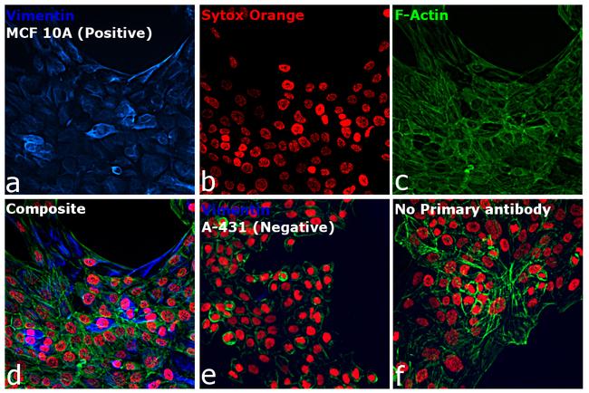 Rabbit IgG (H+L) Cross-Adsorbed Secondary Antibody in Immunocytochemistry (ICC/IF)