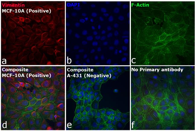 Rabbit IgG (H+L) Cross-Adsorbed Secondary Antibody in Immunocytochemistry (ICC/IF)