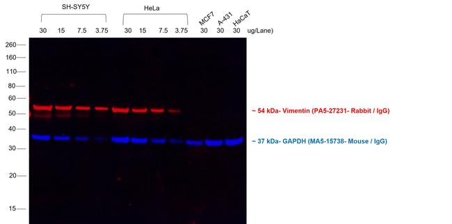 Rabbit IgG (H+L) Cross-Adsorbed Secondary Antibody in Western Blot (WB)