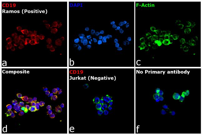 Rat IgG (H+L) Cross-Adsorbed Secondary Antibody in Immunocytochemistry (ICC/IF)