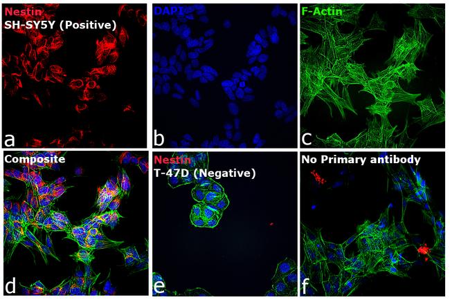 Mouse IgG (H+L) Cross-Adsorbed Secondary Antibody in Immunocytochemistry (ICC/IF)