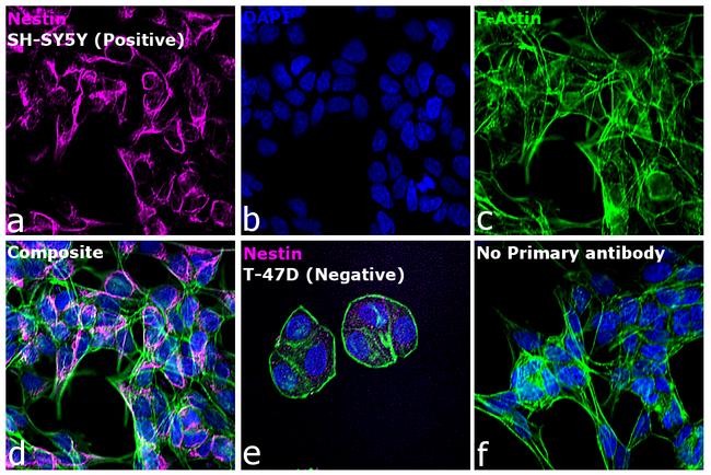 Mouse IgG (H+L) Highly Cross-Adsorbed Secondary Antibody in Immunocytochemistry (ICC/IF)