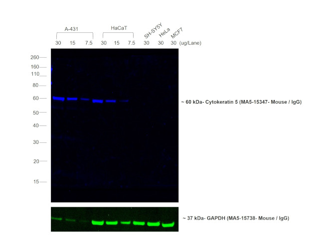 Mouse IgG (H+L) Cross-Adsorbed Secondary Antibody in Western Blot (WB)