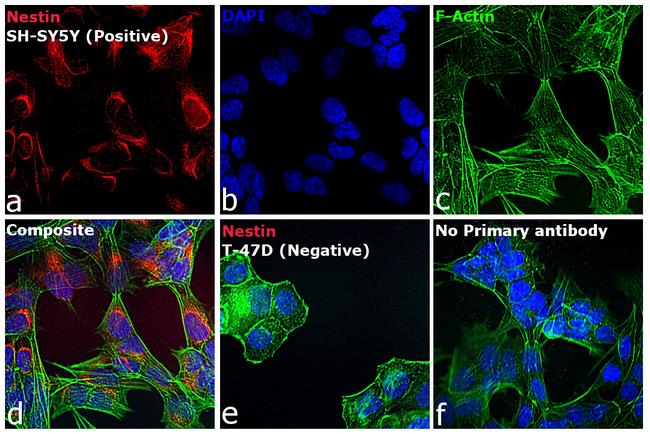 Mouse IgG (H+L) Highly Cross-Adsorbed Secondary Antibody in Immunocytochemistry (ICC/IF)