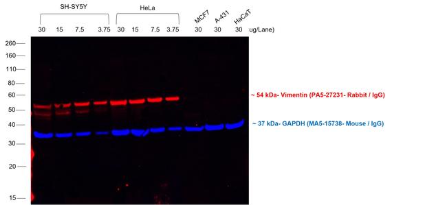 Rabbit IgG (H+L) Highly Cross-Adsorbed Secondary Antibody in Western Blot (WB)