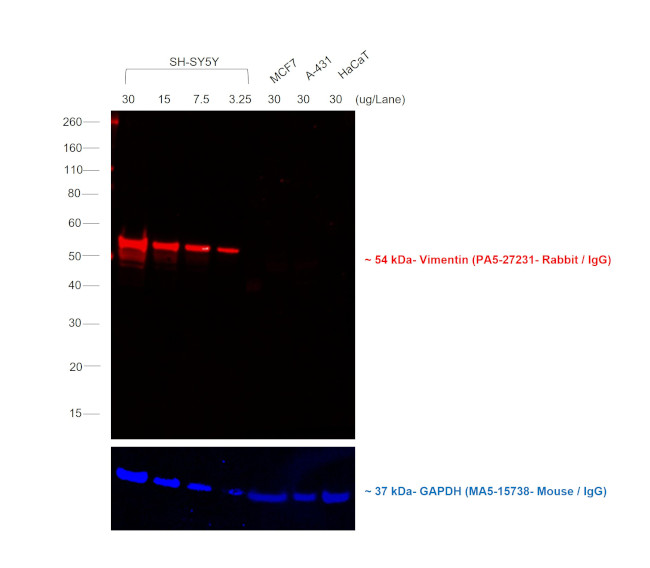 Rabbit IgG (H+L) Cross-Adsorbed Secondary Antibody in Western Blot (WB)