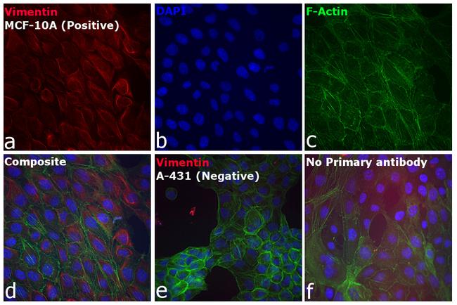 Rabbit IgG (H+L) Cross-Adsorbed Secondary Antibody in Immunocytochemistry (ICC/IF)