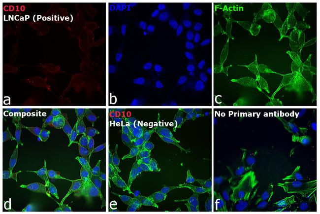 Goat IgG (H+L) Cross-Adsorbed Secondary Antibody in Immunocytochemistry (ICC/IF)