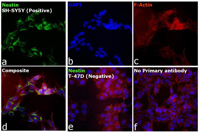 Mouse IgG1 Cross-Adsorbed Secondary Antibody in Immunocytochemistry (ICC/IF)