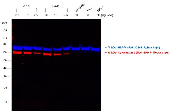 Mouse IgG1 Cross-Adsorbed Secondary Antibody in Western Blot (WB)