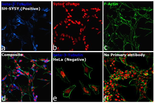 Mouse IgG2a Cross-Adsorbed Secondary Antibody in Immunocytochemistry (ICC/IF)