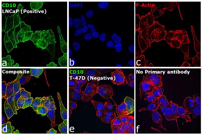 Mouse IgG2b Cross-Adsorbed Secondary Antibody in Immunocytochemistry (ICC/IF)