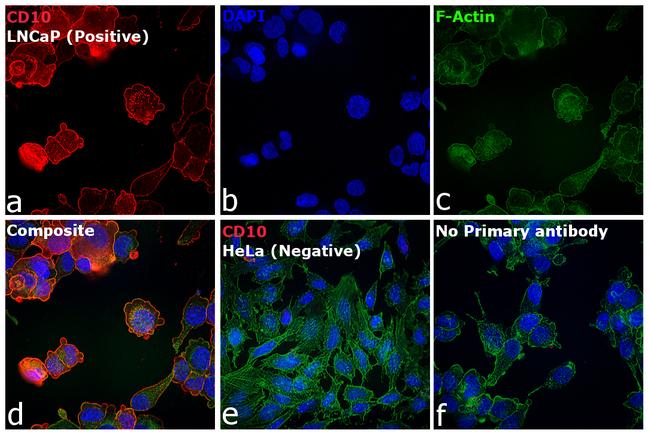 Mouse IgG2b Cross-Adsorbed Secondary Antibody in Immunocytochemistry (ICC/IF)