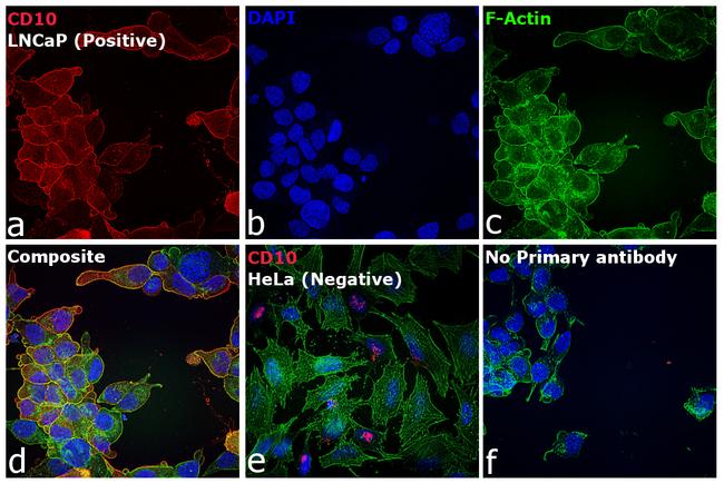 Mouse IgG2b Cross-Adsorbed Secondary Antibody in Immunocytochemistry (ICC/IF)