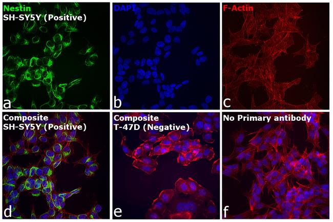 Mouse IgG (H+L) Cross-Adsorbed Secondary Antibody in Immunocytochemistry (ICC/IF)