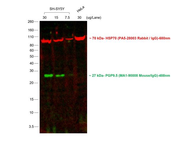 Mouse IgG (H+L) Cross-Adsorbed Secondary Antibody in Western Blot (WB)