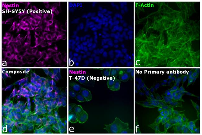 Mouse IgG (H+L) Cross-Adsorbed Secondary Antibody in Immunocytochemistry (ICC/IF)