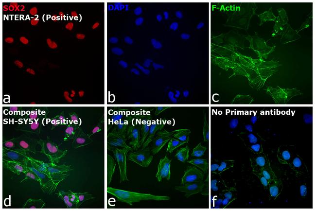 Rat IgG (H+L) Cross-Adsorbed Secondary Antibody in Immunocytochemistry (ICC/IF)