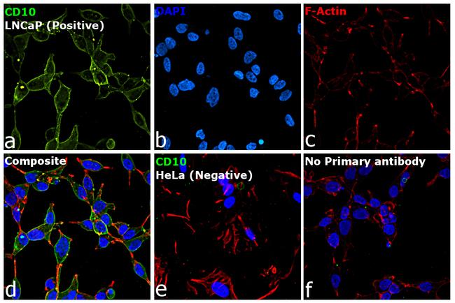 Goat IgG (H+L) Cross-Adsorbed Secondary Antibody in Immunocytochemistry (ICC/IF)