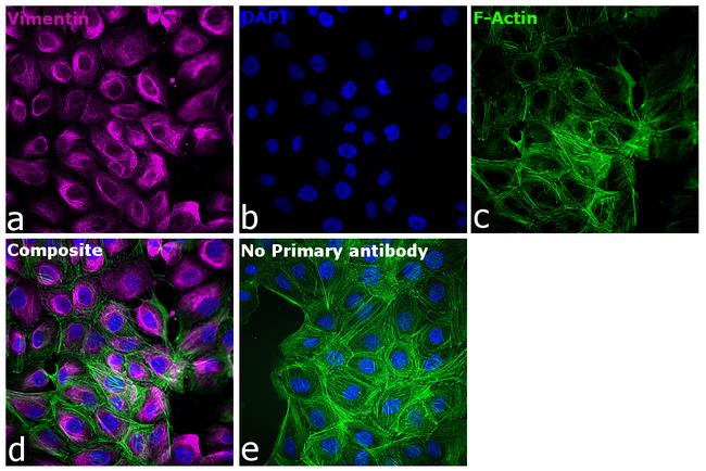 Mouse IgG1 Cross-Adsorbed Secondary Antibody in Immunocytochemistry (ICC/IF)