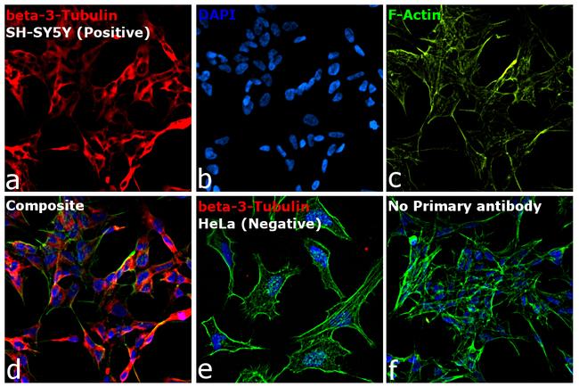 Mouse IgG2a Cross-Adsorbed Secondary Antibody in Immunocytochemistry (ICC/IF)