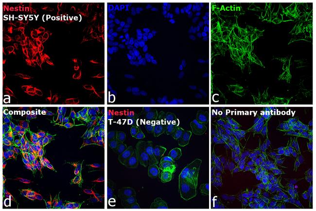 Mouse IgG (H+L) Cross-Adsorbed Secondary Antibody in Immunocytochemistry (ICC/IF)