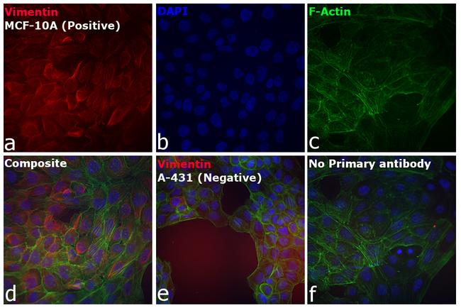 Chicken IgY (H+L) Secondary Antibody in Immunocytochemistry (ICC/IF)