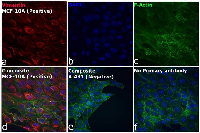 Rabbit IgG (H+L) Cross-Adsorbed Secondary Antibody in Immunocytochemistry (ICC/IF)