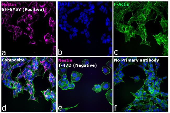 Mouse IgG (H+L) Cross-Adsorbed Secondary Antibody in Immunocytochemistry (ICC/IF)