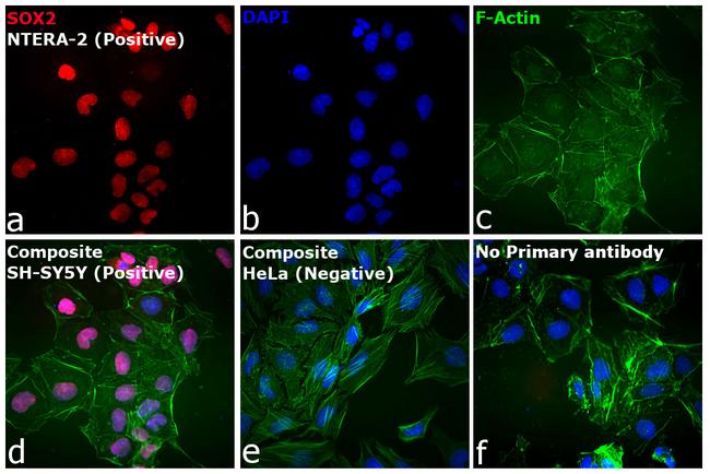 Rat IgG (H+L) Cross-Adsorbed Secondary Antibody in Immunocytochemistry (ICC/IF)