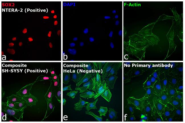 Rat IgG (H+L) Cross-Adsorbed Secondary Antibody in Immunocytochemistry (ICC/IF)