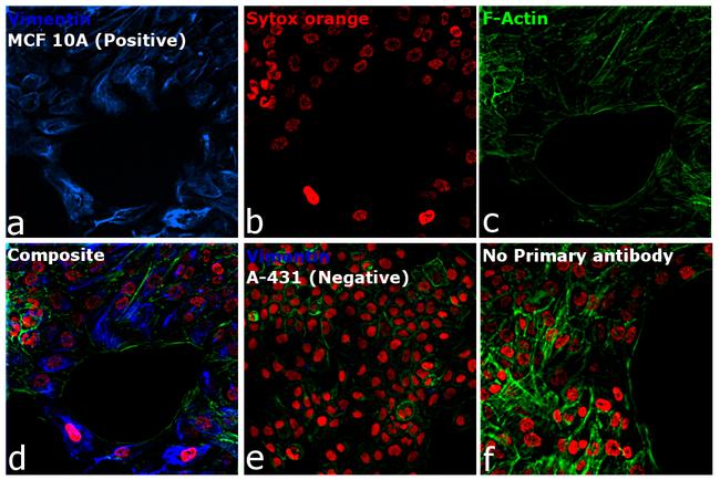 Rabbit IgG (H+L) Cross-Adsorbed Secondary Antibody in Immunocytochemistry (ICC/IF)