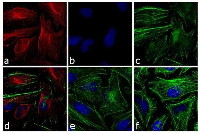 Mouse IgG (H+L) Highly Cross-Adsorbed Secondary Antibody in Immunocytochemistry (ICC/IF)