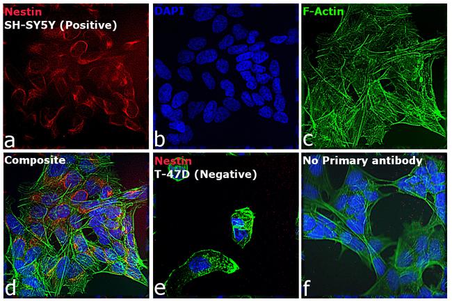 Mouse IgG (H+L) Highly Cross-Adsorbed Secondary Antibody in Immunocytochemistry (ICC/IF)