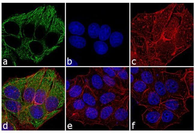 Mouse IgG, IgM (H+L) Secondary Antibody in Immunocytochemistry (ICC/IF)