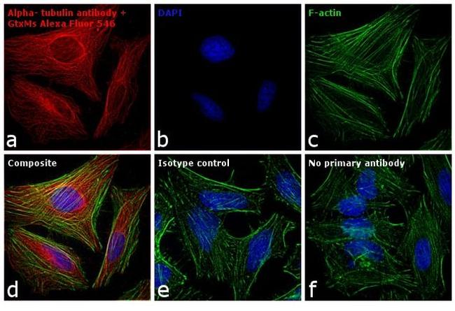 Mouse IgG (H+L) Cross-Adsorbed Secondary Antibody in Immunocytochemistry (ICC/IF)