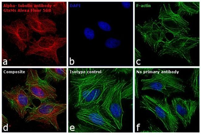 Mouse IgG (H+L) Cross-Adsorbed Secondary Antibody in Immunocytochemistry (ICC/IF)