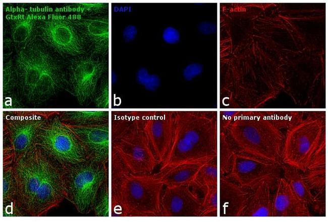 Rat IgG (H+L) Cross-Adsorbed Secondary Antibody in Immunocytochemistry (ICC/IF)