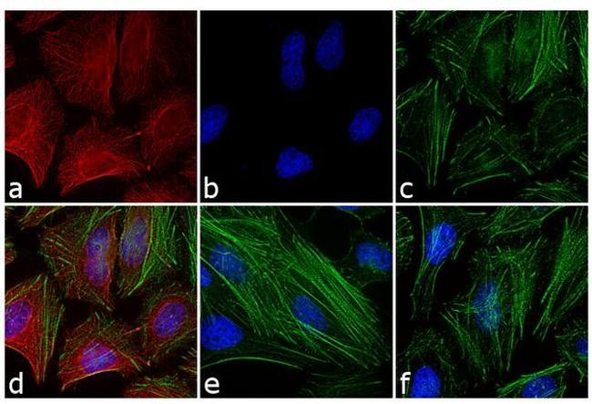 Mouse IgG (H+L) Cross-Adsorbed Secondary Antibody in Immunocytochemistry (ICC/IF)