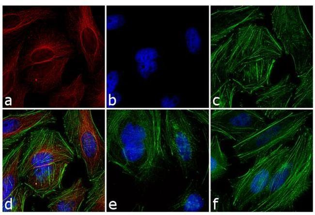 Mouse IgG (H+L) Highly Cross-Adsorbed Secondary Antibody in Immunocytochemistry (ICC/IF)