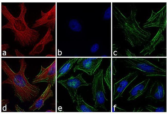 Mouse IgG (H+L) Highly Cross-Adsorbed Secondary Antibody in Immunocytochemistry (ICC/IF)