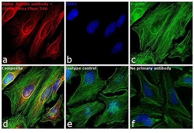 Rabbit IgG (H+L) Highly Cross-Adsorbed Secondary Antibody in Immunocytochemistry (ICC/IF)