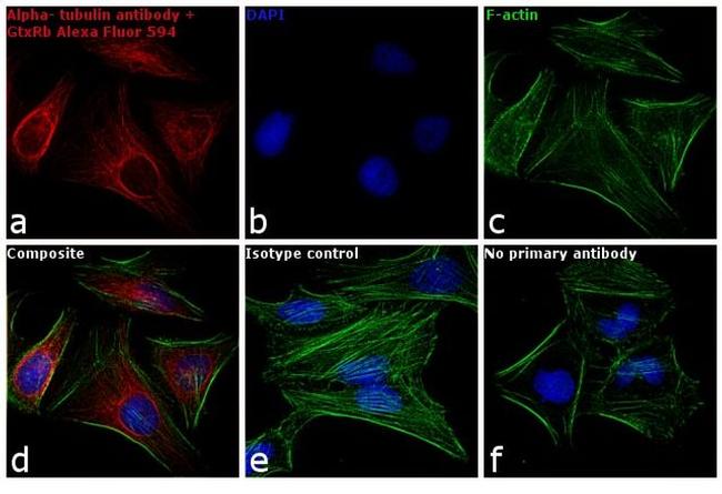 Rabbit IgG (H+L) Highly Cross-Adsorbed Secondary Antibody in Immunocytochemistry (ICC/IF)