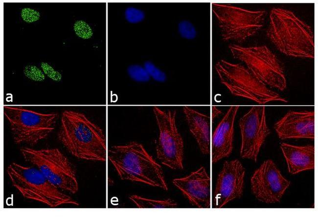 Rabbit IgG (H+L) Cross-Adsorbed Secondary Antibody in Immunocytochemistry (ICC/IF)