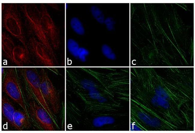 Mouse IgG (H+L) Highly Cross-Adsorbed Secondary Antibody in Immunocytochemistry (ICC/IF)