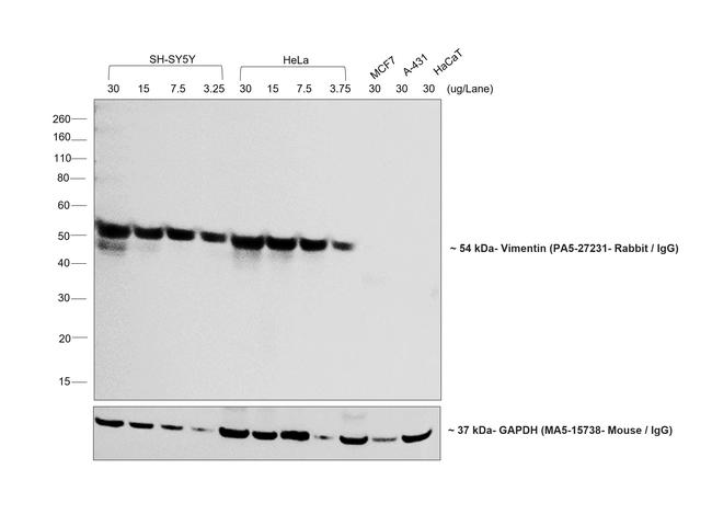 Rabbit IgG (H+L) Highly Cross-Adsorbed Secondary Antibody in Western Blot (WB)