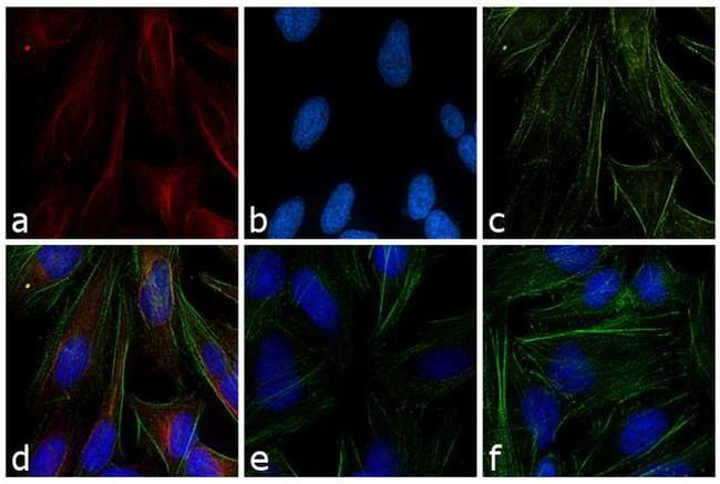 Mouse IgG (H+L) Cross-Adsorbed Secondary Antibody in Immunocytochemistry (ICC/IF)