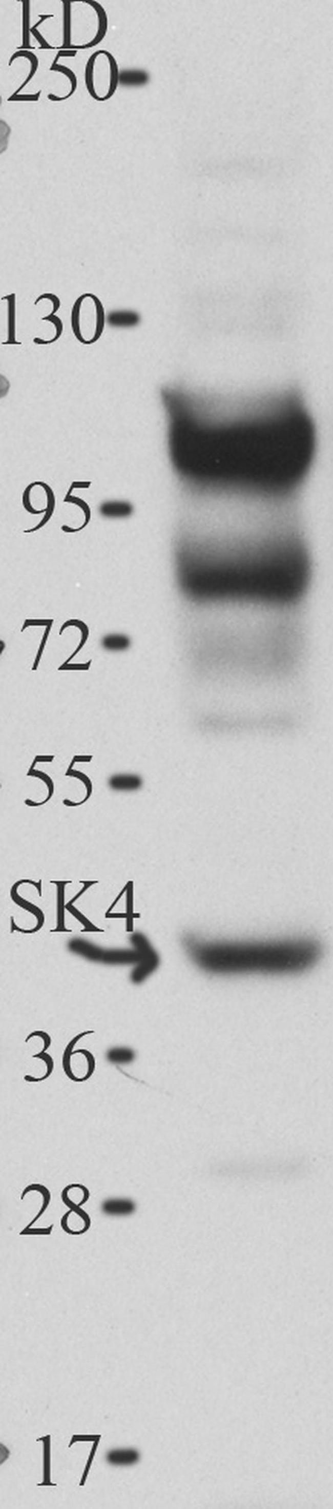 Rabbit IgG (H+L) Cross-Adsorbed Secondary Antibody in Western Blot (WB)