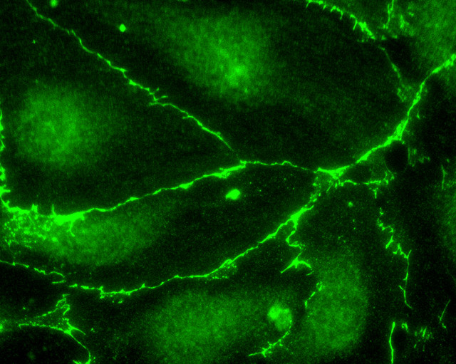 ECS (DYKDDDDK) Tag Antibody in Immunocytochemistry (ICC/IF)