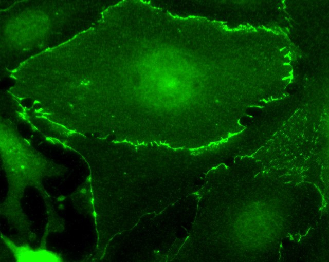 Myc Tag Antibody in Immunocytochemistry (ICC/IF)